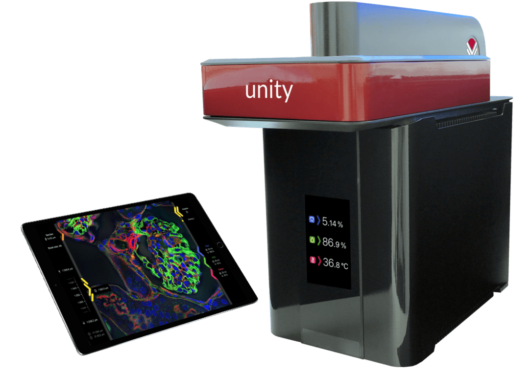 Aurox Unity-life laser free confocal spinning disk microscope system