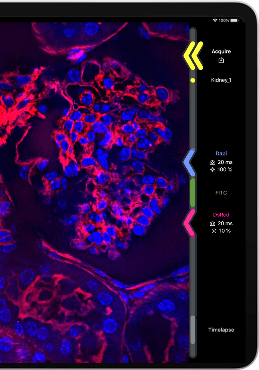 Aurox Unity iPAD blue and red channel mouse kidney confocal